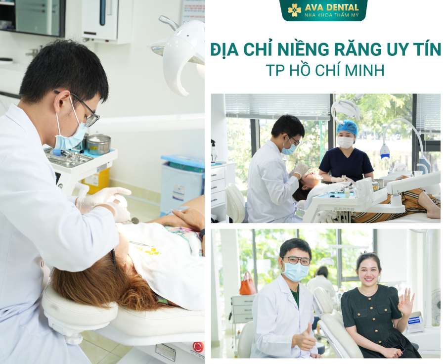  28 tuổi có niềng răng
