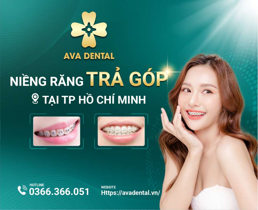 niềng răng trả góp TPHCM