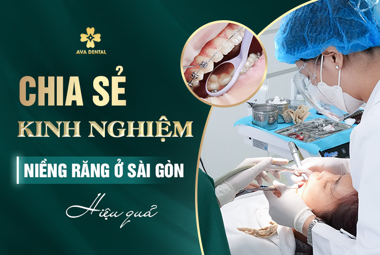 niềng răng ở sài gòn