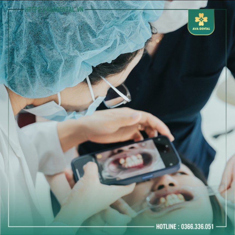 niềng răng trả góp