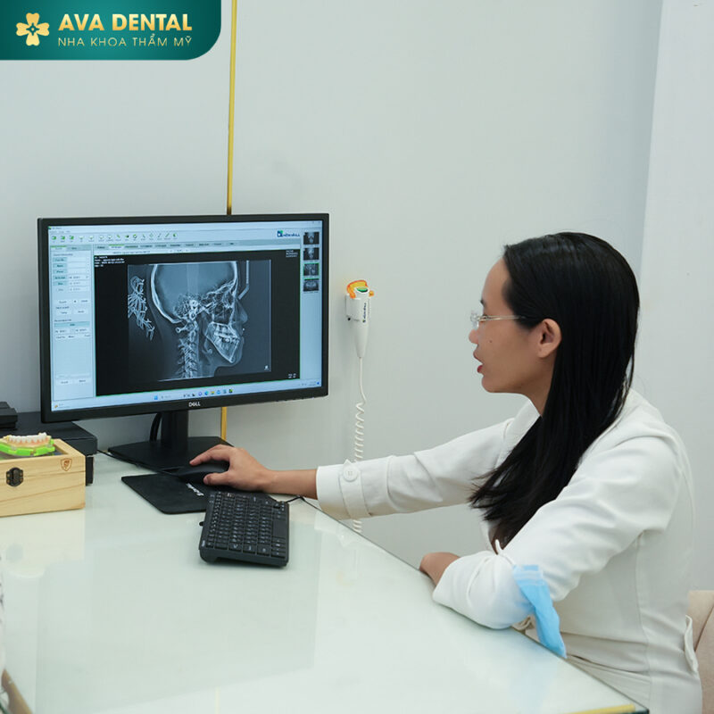 độ tuổi niềng răng