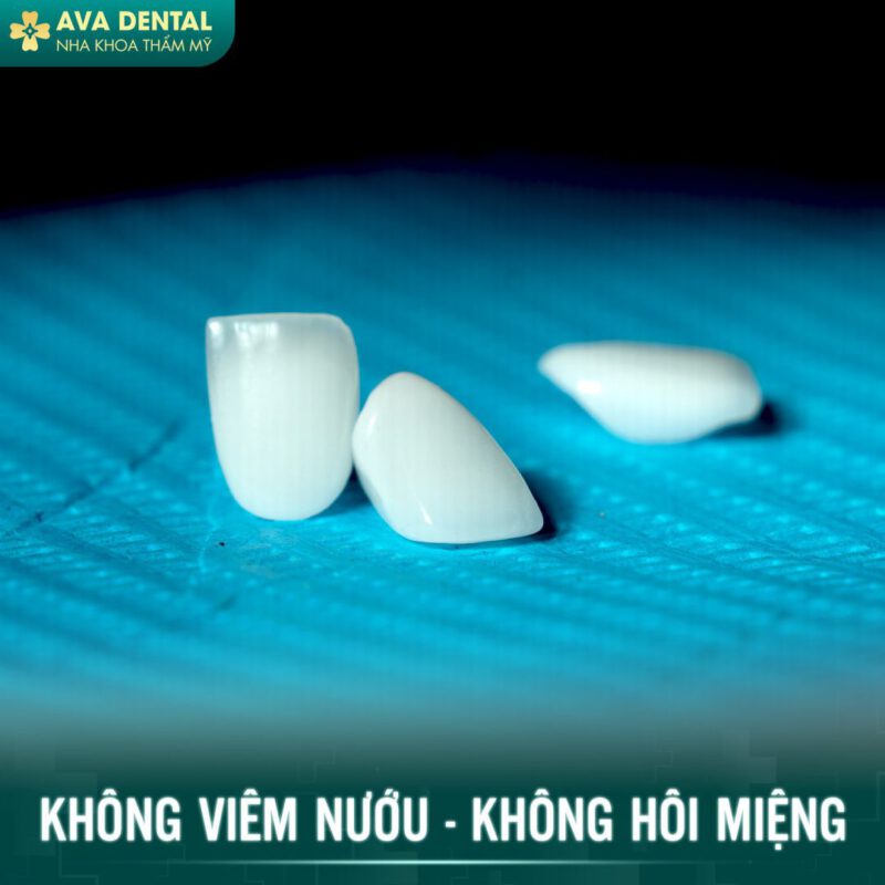 các loại răng sứ