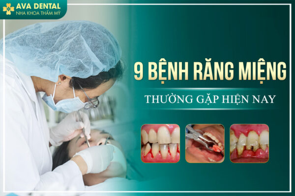 9 BENH