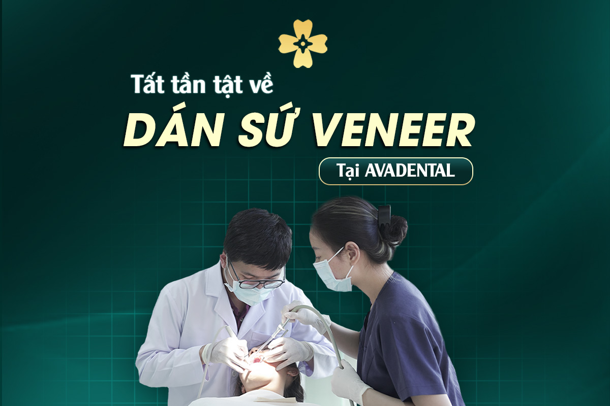 Cùng Avora Dental Tìm Hiểu Tất Tần Tật Về Dán Sứ Veneer 8 DAN SU VENEER