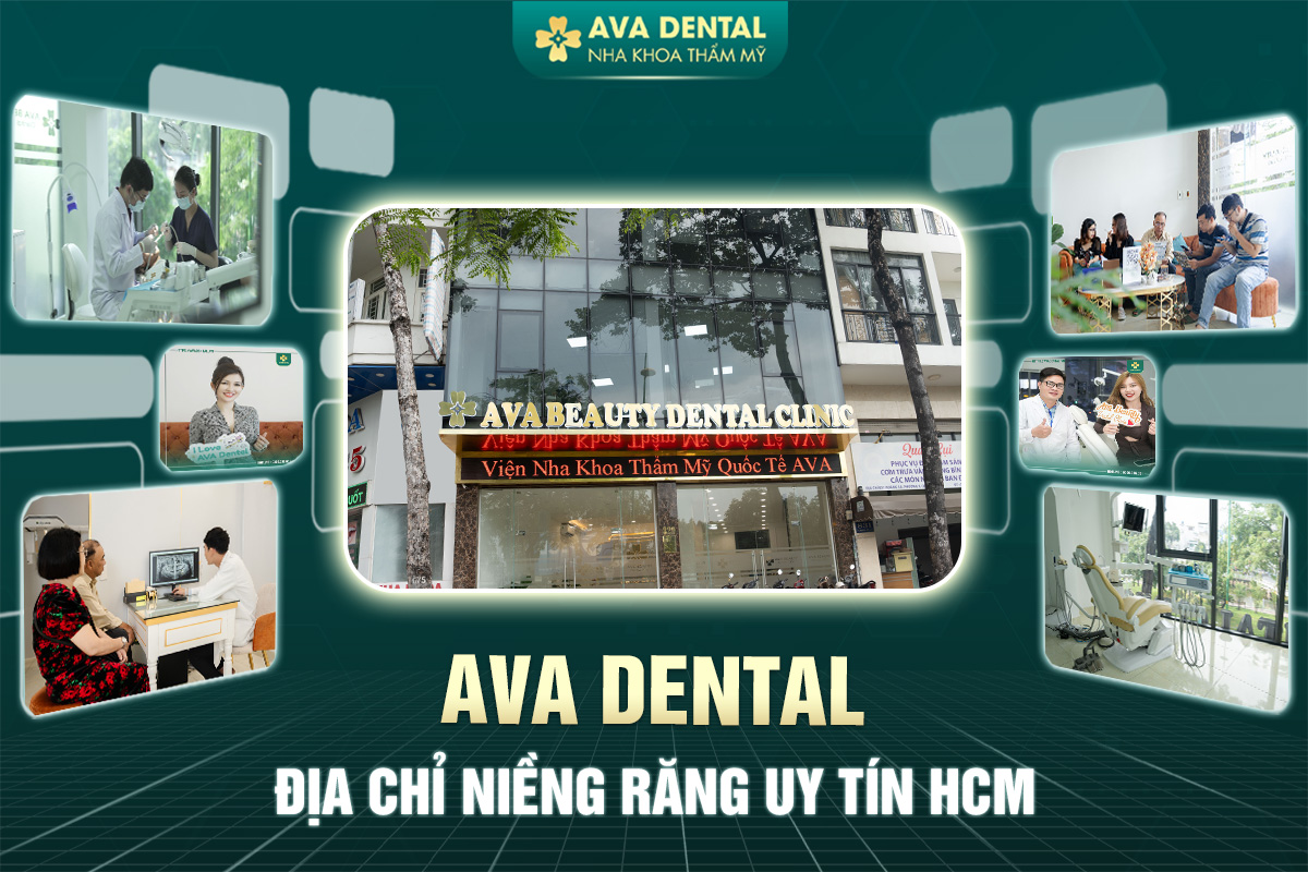 Avora Dental - Địa Chỉ Cơ Sở Nha Khoa Niềng Răng Uy Tín HCM 6 niềng răng uy tín hcm