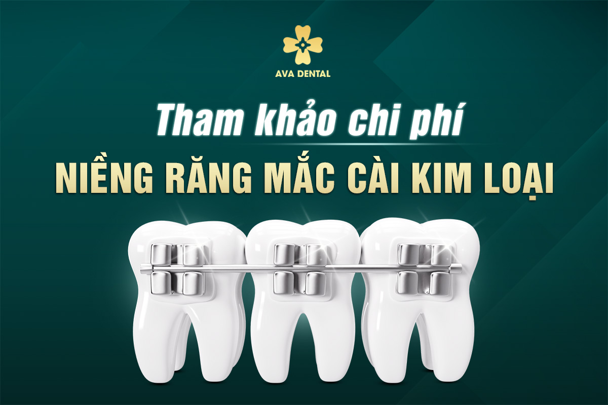 Tham Khảo Giá Niềng Răng Mắc Cài Kim Loại 8 giá niềng răng