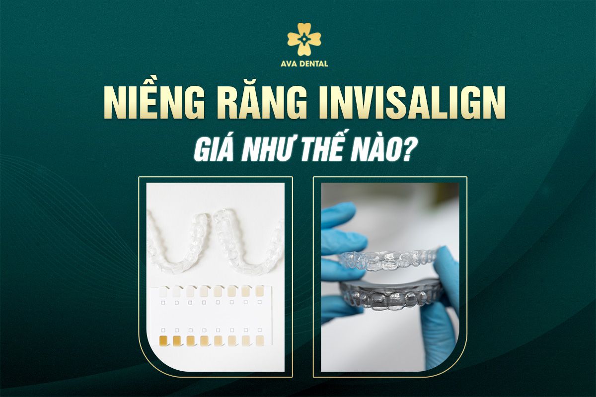 niềng răng invisalign giá