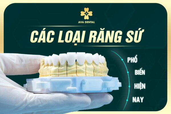 RANG SU