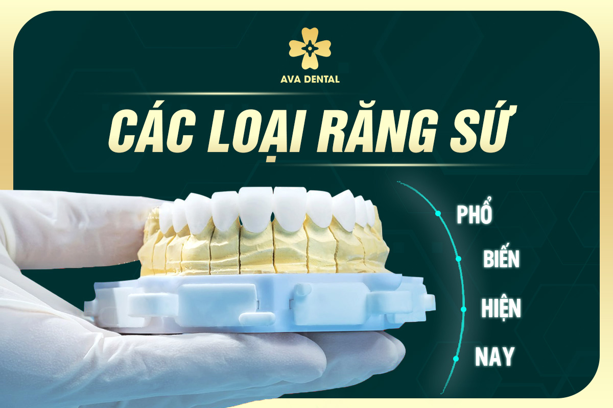 Tìm Hiểu Các Loại Răng Sứ Phổ Biến Hiện Nay - Avora Dental 7 các loại răng sứ