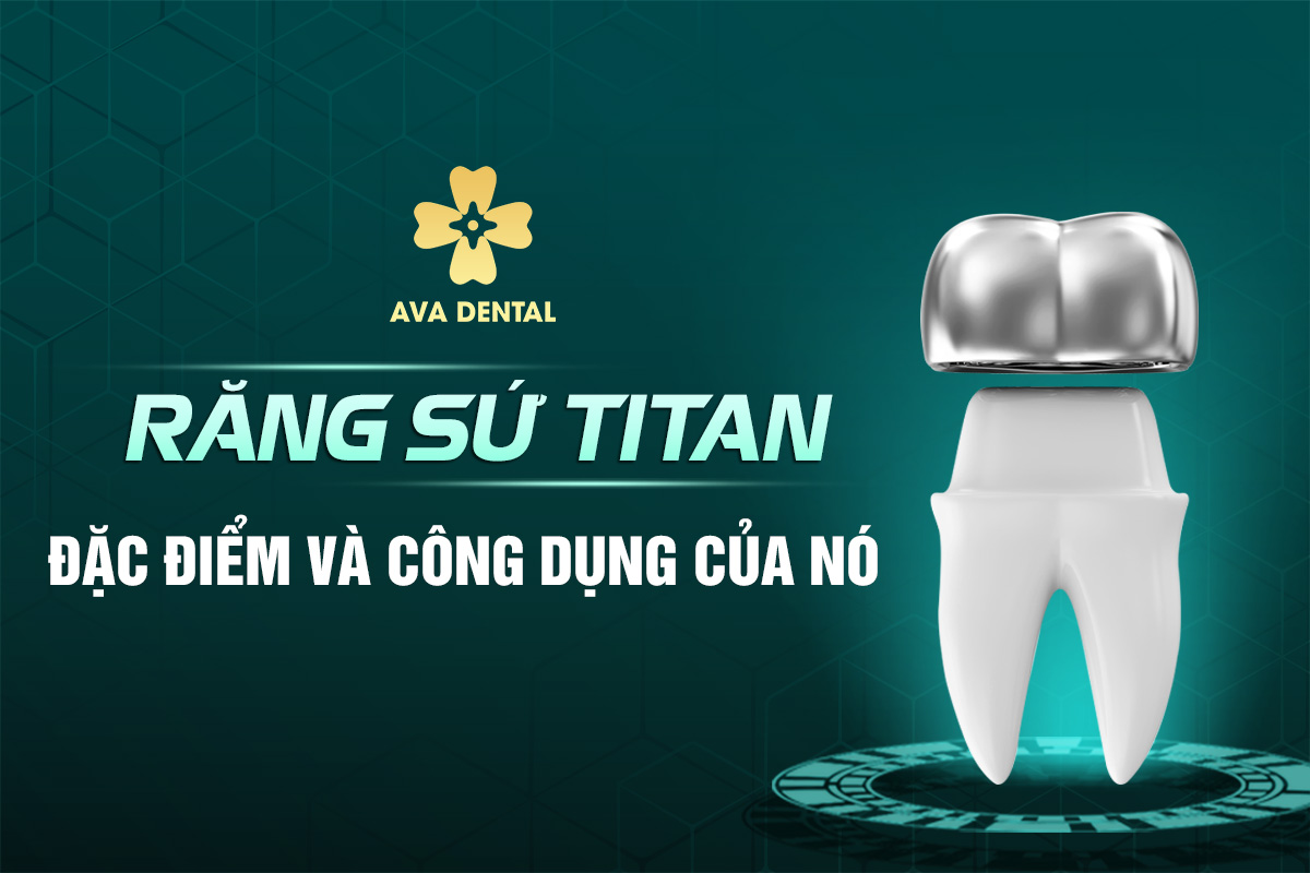Răng Sứ Titan - Tìm Hiểu Đặc Điểm Và Công Dụng 7 răng sứ titan
