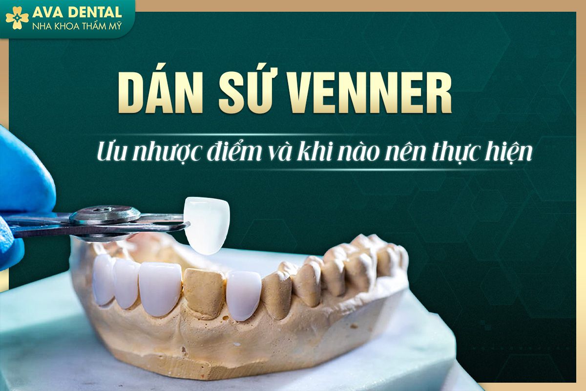 SU VENNER 1