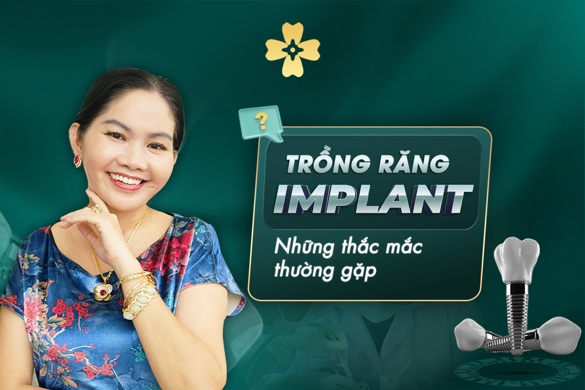 Trồng Răng Implant - Những Thắc Mắc Thường Gặp 8 TRONG RANG IMPLANT