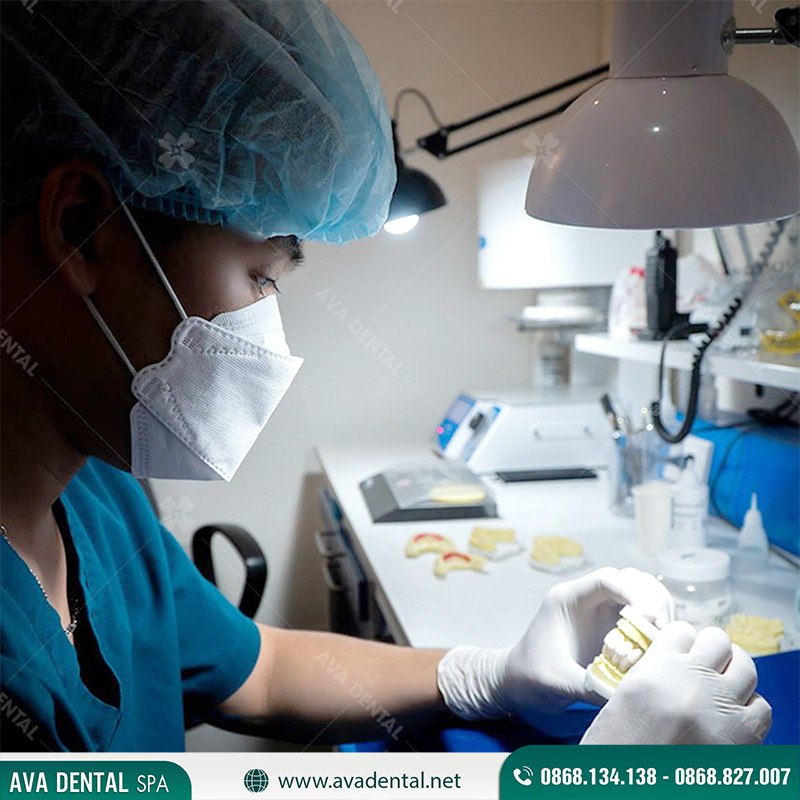 giá bọc răng sứ