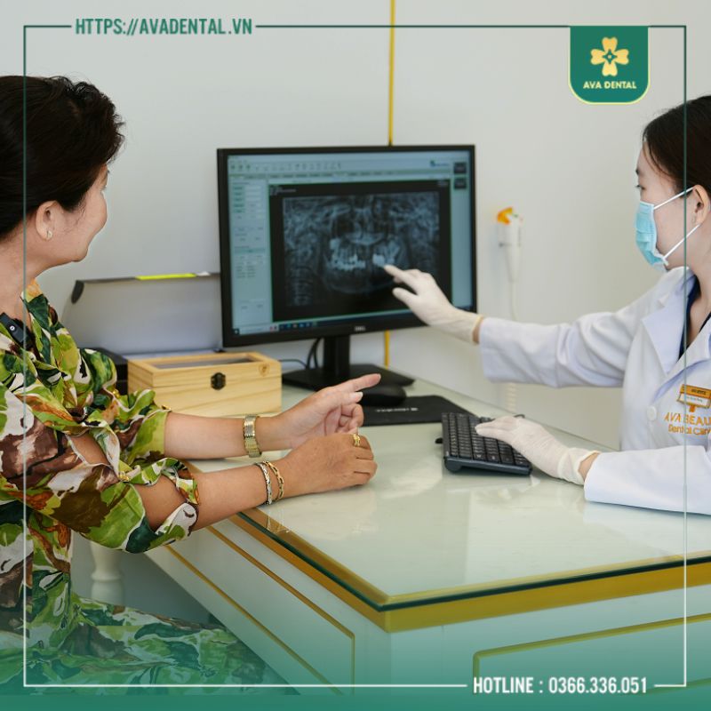 làm răng implant