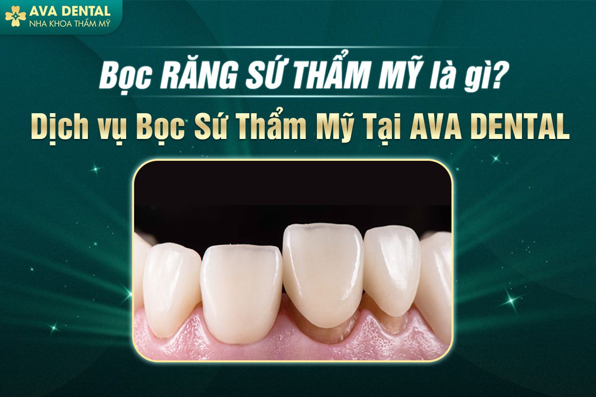 Bọc Răng Sứ Thẩm Mỹ Là Gì? Dịch Vụ Bọc Sứ Thẩm Mỹ Tại Avora Dental 6 răng sứ thẩm mỹ
