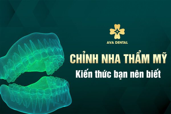 CHINH NHA