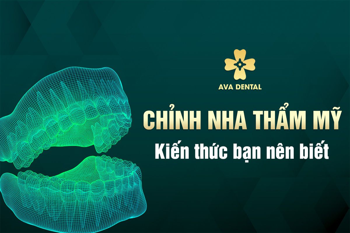 chỉnh nha thẩm mỹ