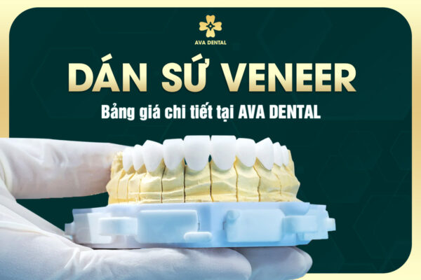 DAN SU VENE