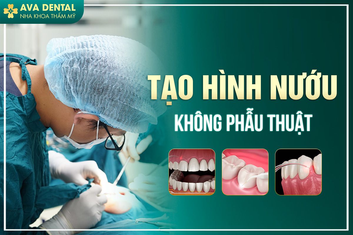 tạo hình nướu