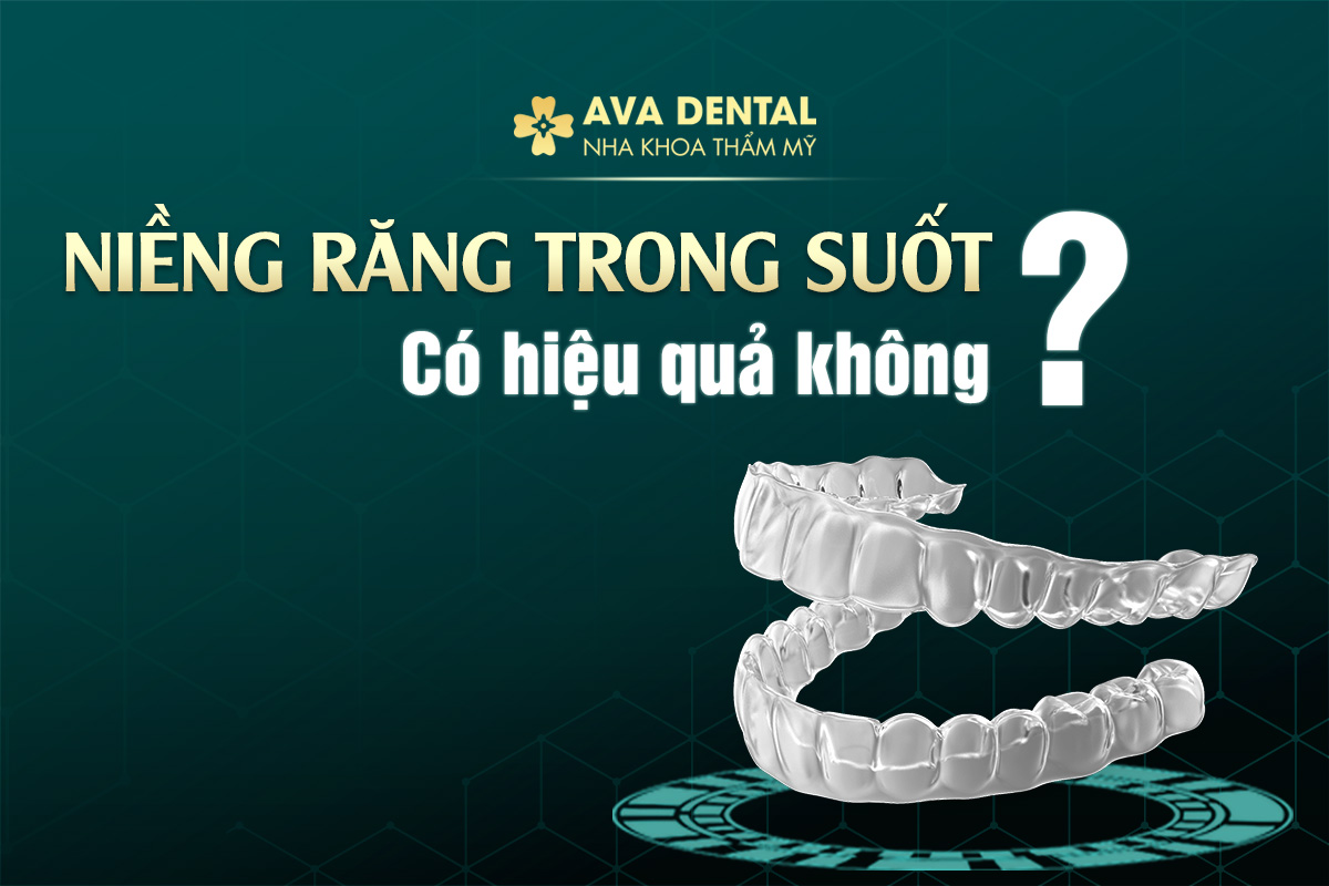 NIỀNG RĂNG TRONG SUỐT CÓ HIỆU QUẢ KHÔNG? 8 niềng răng trong suốt