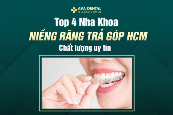 TOP 4 NK NR