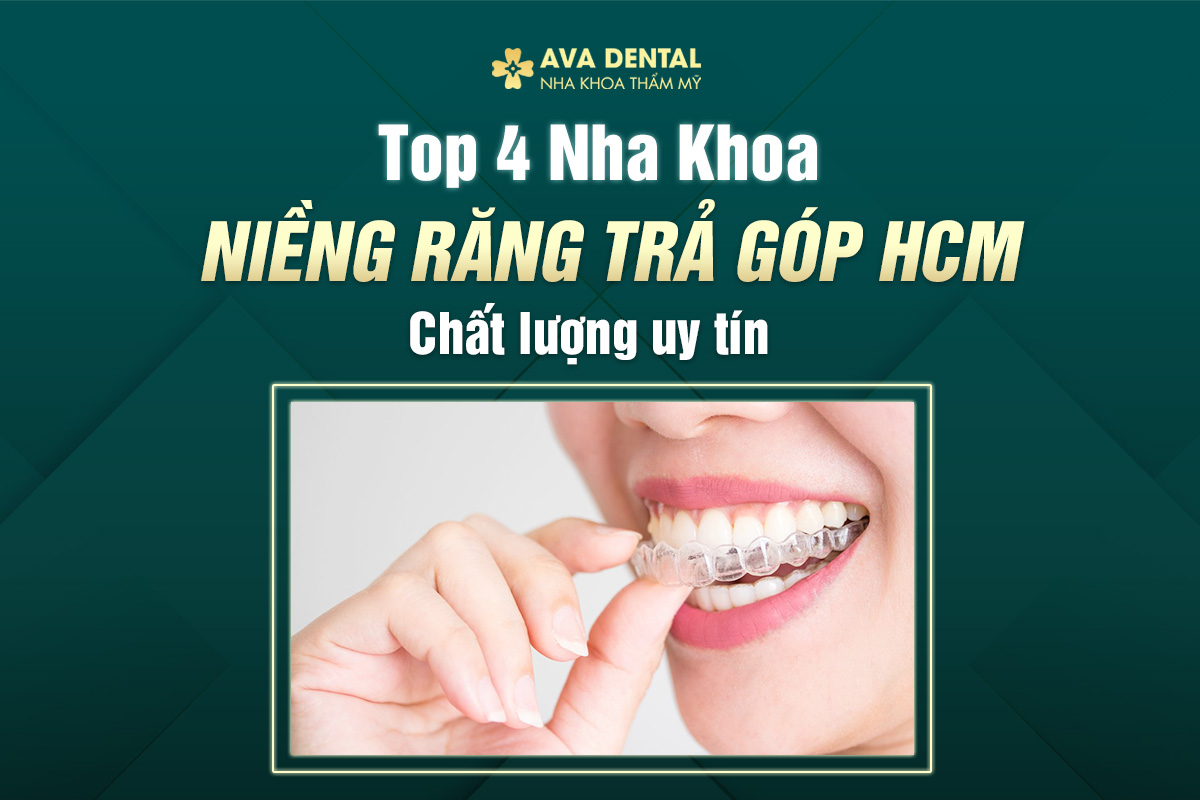 TOP 4 NK NR