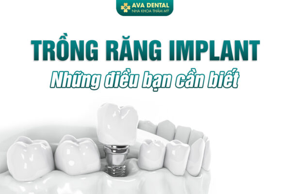 TRONG IMPL 1
