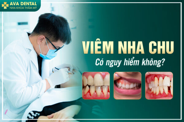 VIEM NHA CHU