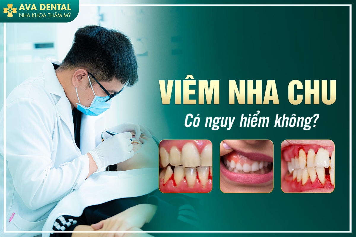 Viêm Nha Chu