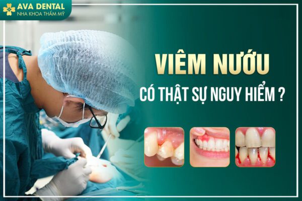 VIEM NUOU