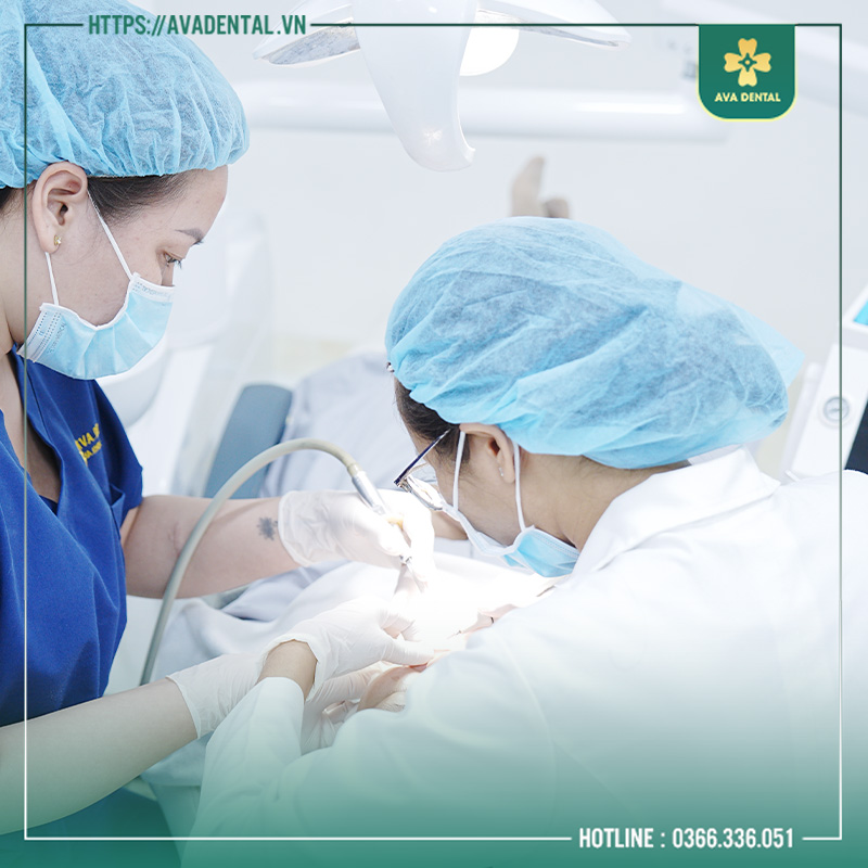 Chi Phí Bọc Sứ Răng Cửa Bao Nhiêu Tiền? 10 bọc sứ răng cửa bao nhiêu tiền