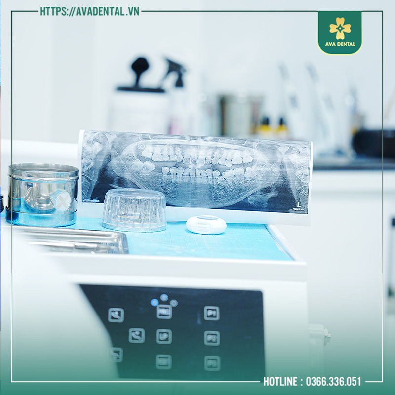 niềng răng tốt ở tphcm