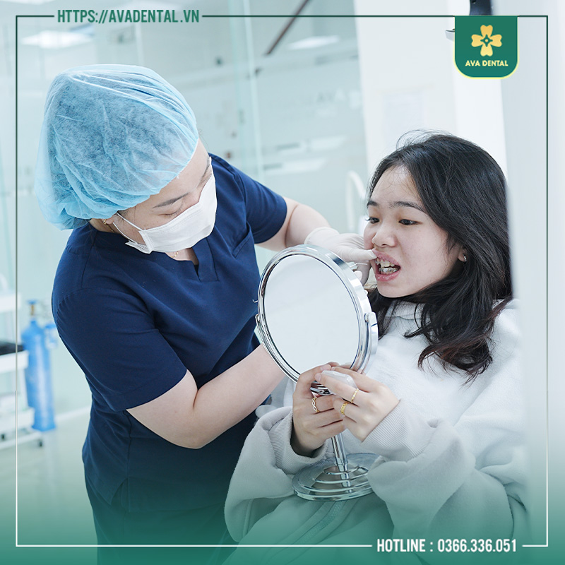 Đâu Là Nơi Niềng Răng Tốt Ở Tphcm? Những Thông Tin Cần Biết 11 niềng răng tốt ở tphcm
