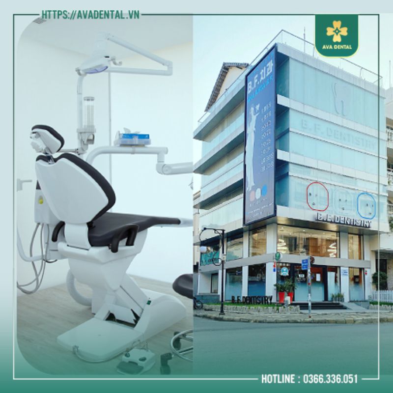 địa chỉ niềng răng uy tín ở sài gòn