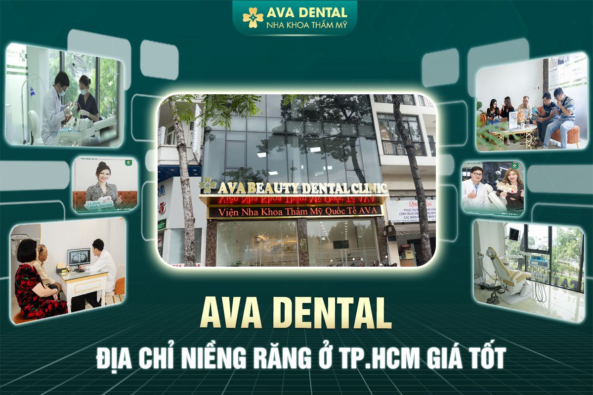 Nha khoa Avora Dental - Địa chỉ niềng răng ở TP HCM Giá Tốt 9 niềng răng ở tp hcm