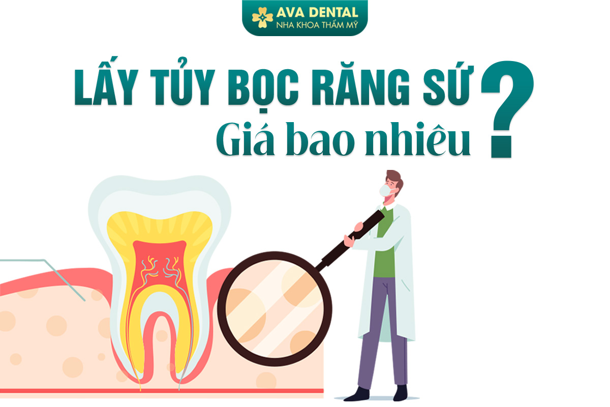 Lấy Tủy Bọc Răng Sứ Giá Bao Nhiêu? 7 lấy tủy bọc răng sứ giá bao nhiêu