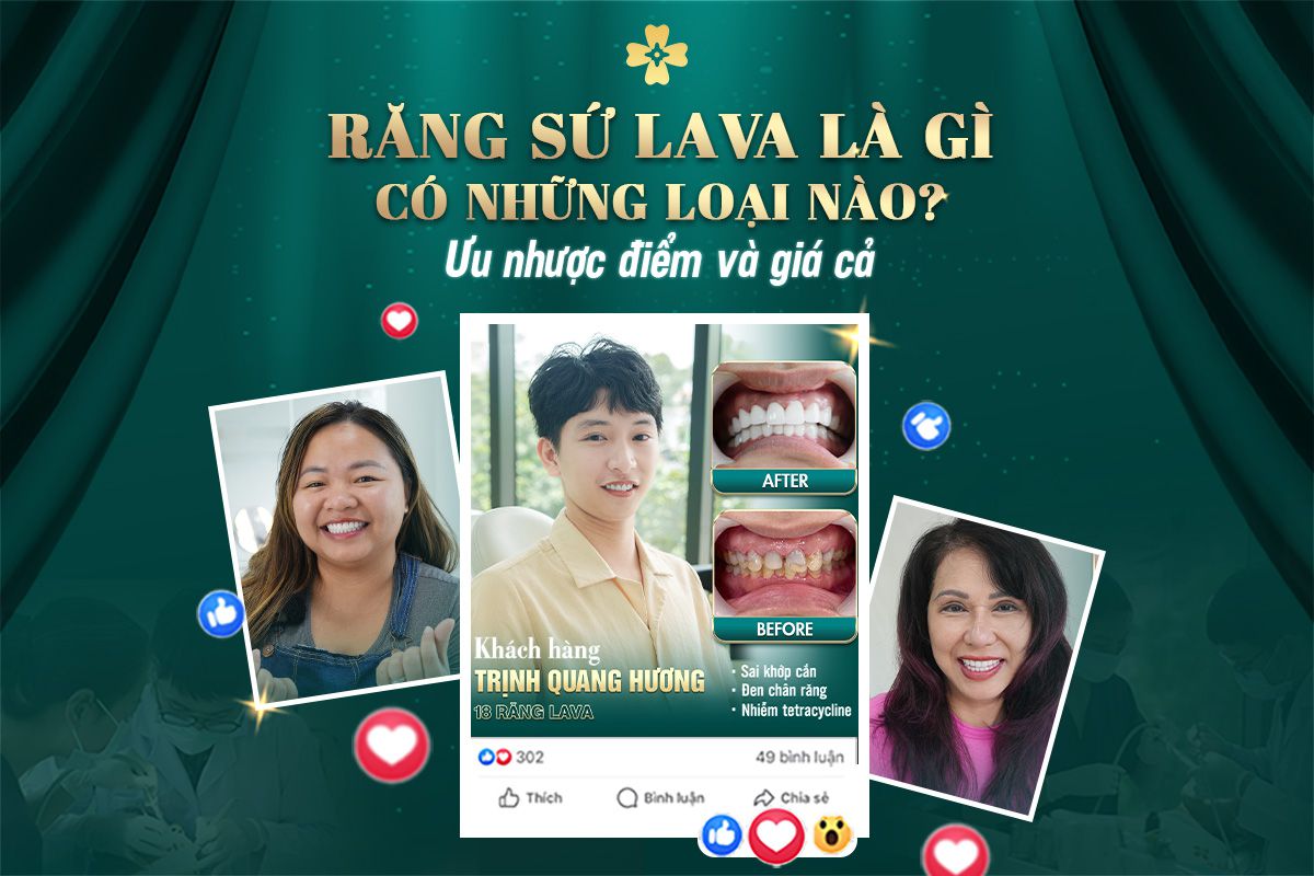 răng sứ lava
