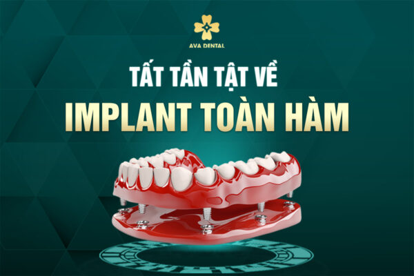 IMPLANT HAM