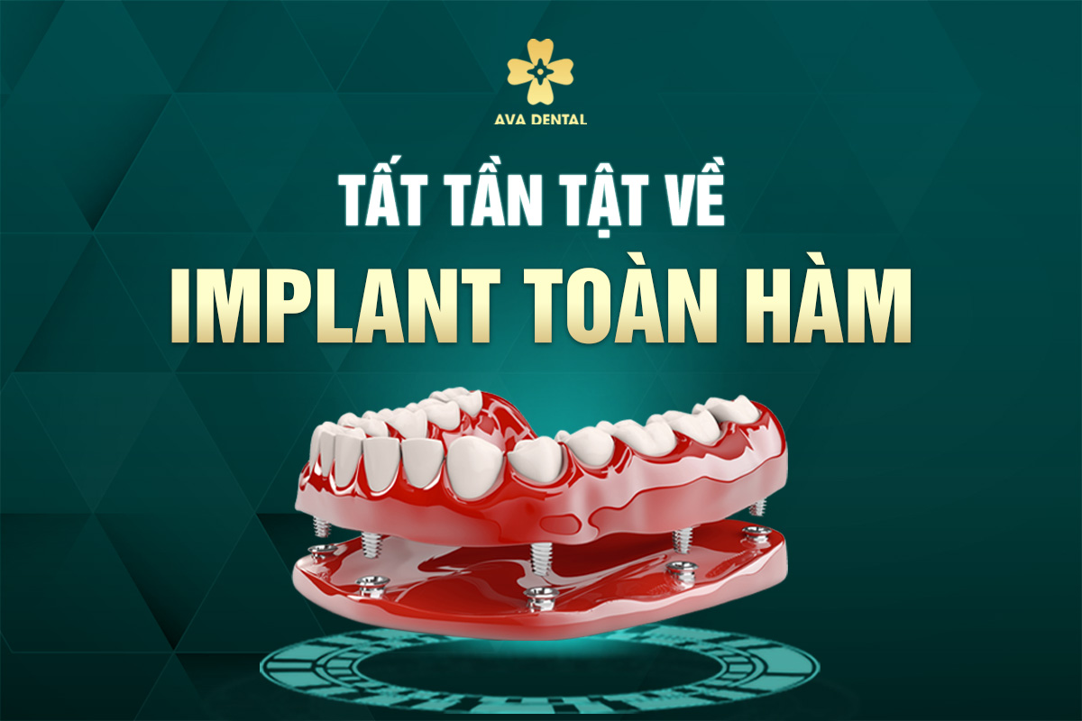 IMPLANT HAM