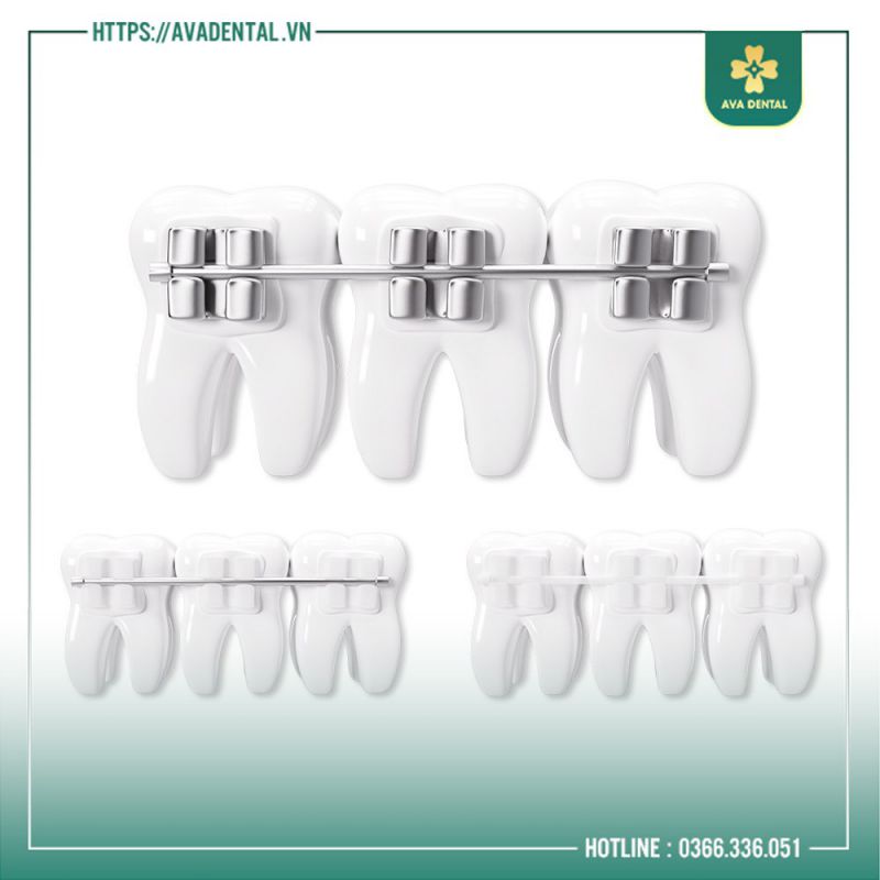 nha khoa nào niềng răng tốt ở tphcm
