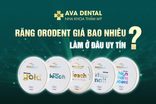 ORO GIA BAO NHIEU