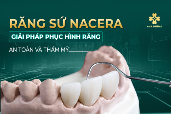 Rang Su Nacera 1