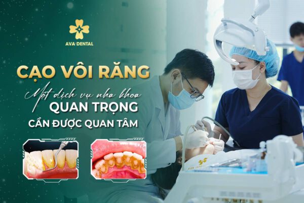 baner Cao Voi Rang