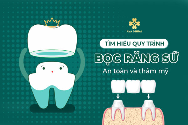 tim hieu quy trinh boc rang su 1