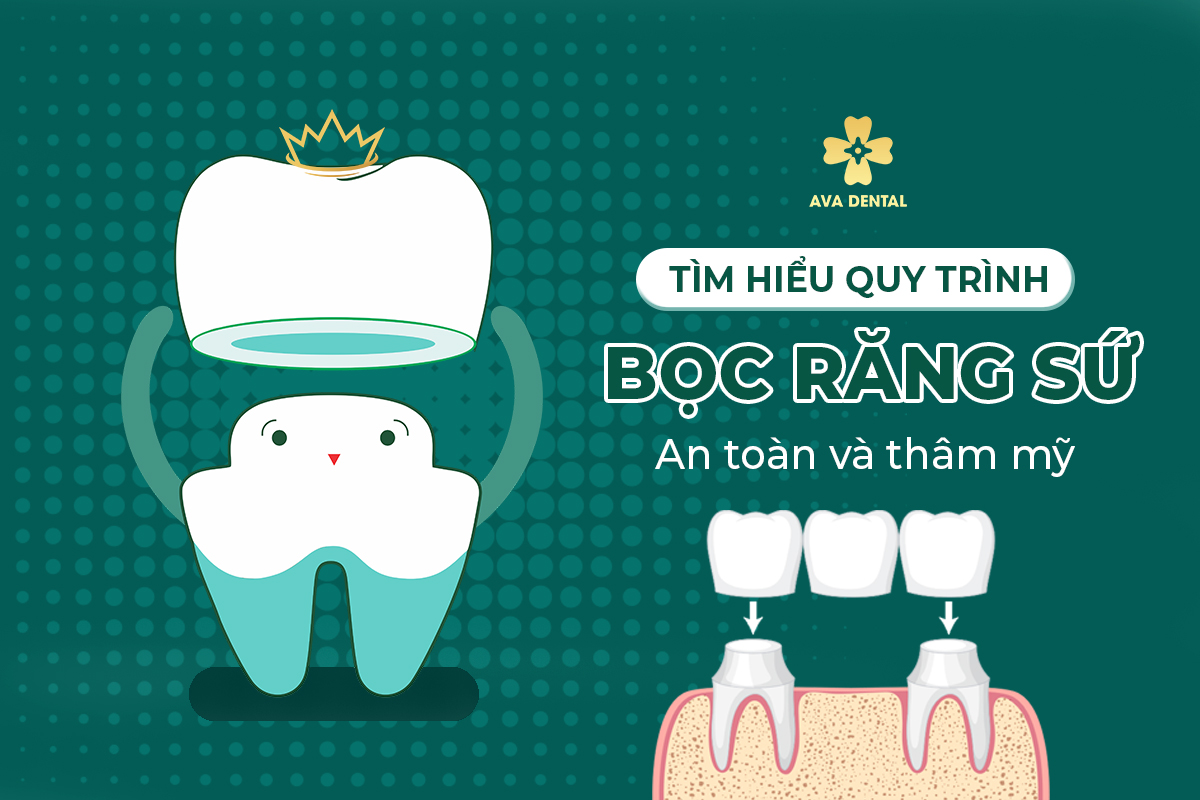 quy trình bọc răng