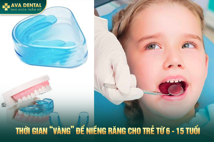 Niềng Răng Cho Trẻ Em: Độ Tuổi Và Chi Phí Bao Nhiêu 2024? 17 1 10