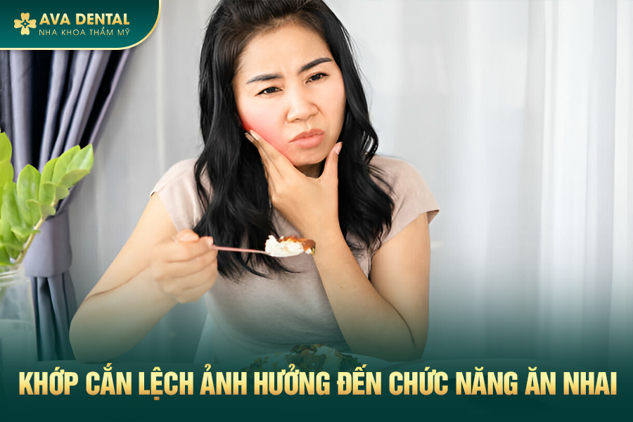 Khớp Cắn Lệch Là Gì? Chi Phí Niềng Khớp Cắn Lệch Giá Tốt Tại TP.HCM 17 12 1