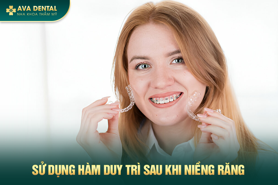 Chi Phí Niềng Răng Mắc Cài Sứ Bao Nhiêu 2024? 17 182 1
