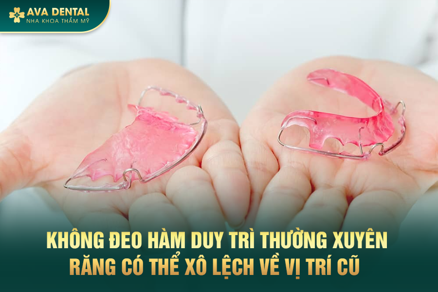 Có Nên Niềng Răng Lần 2 Không? Giá Bao Nhiêu? Ở Đâu Uy Tín Tại TP.HCM 14 2 7