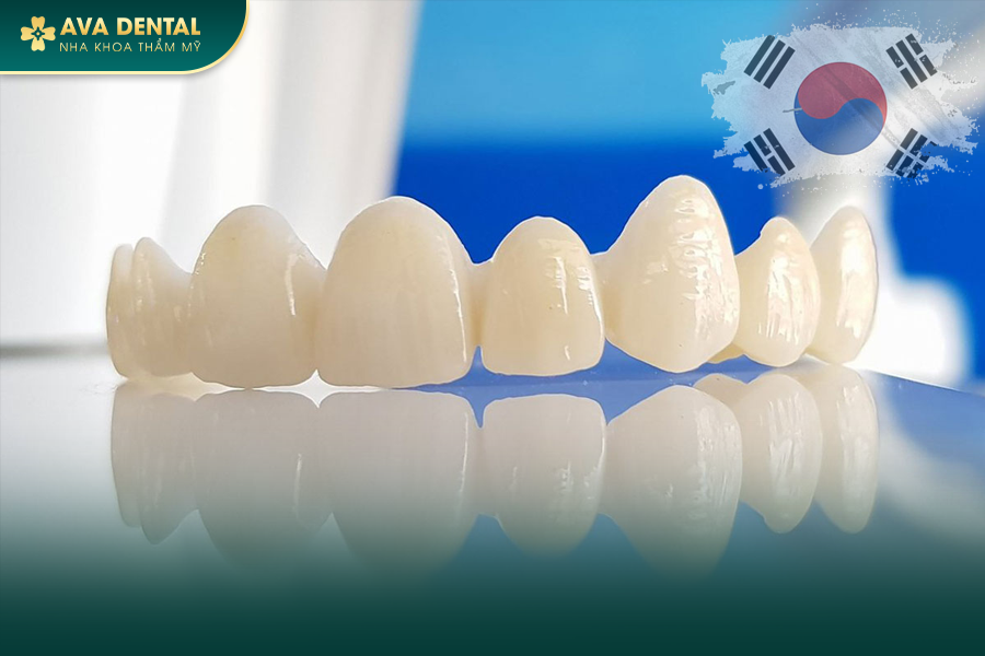 Răng Sứ Hàn Quốc Là Gì? Có Tốt Không? Bảng Giá Mới Nhất 2024 13 20 1